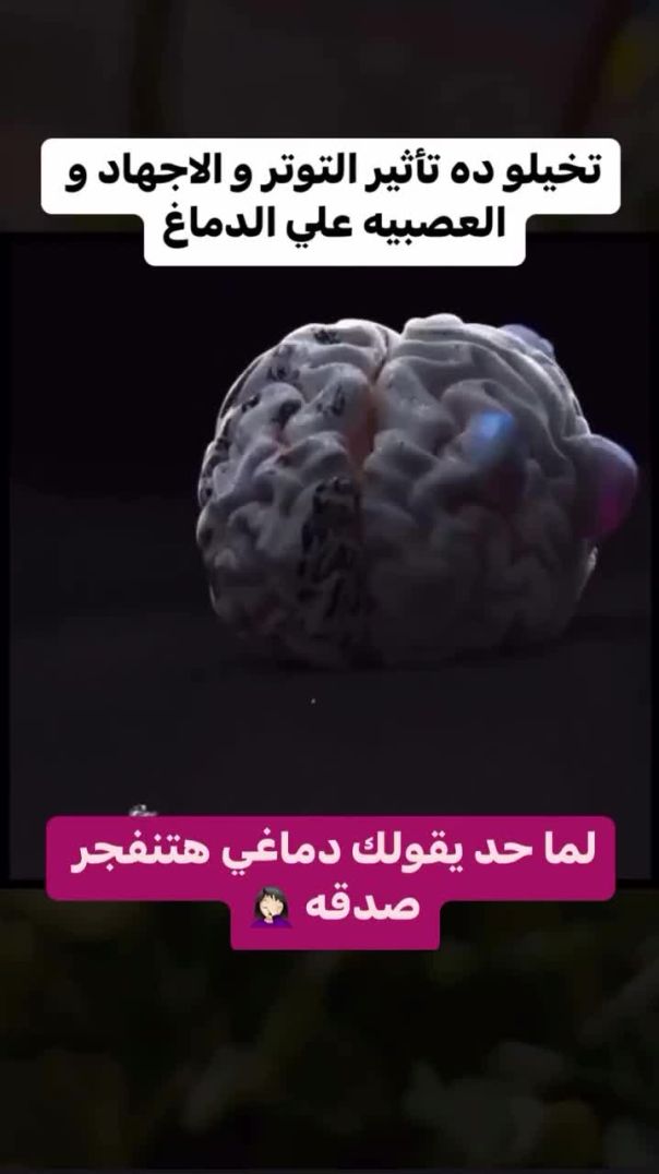 وجع الدماغ