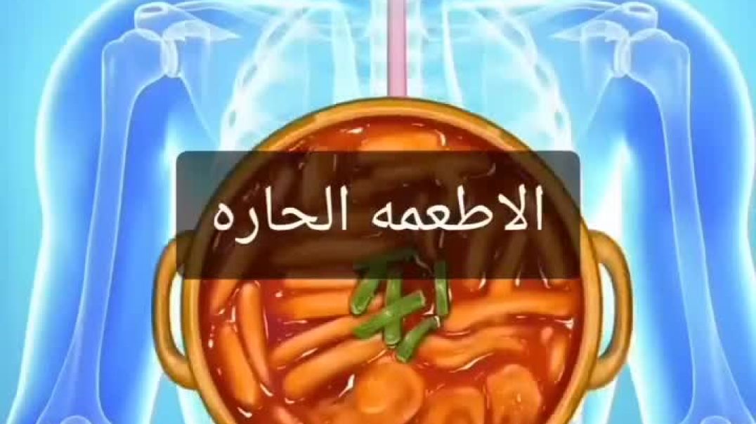 💥اطعمة_مريحة_للقولون💥